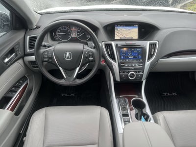 2016 Acura TLX V6 Tech